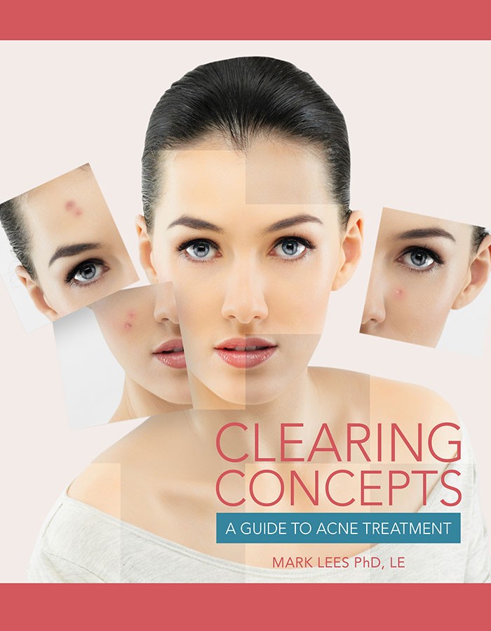 Clearing Concepts: A Guide to Acne Treatment Clearing Concepts: A Guide to Acne Treatment