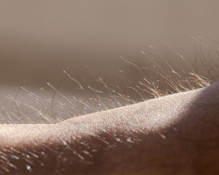 Electrolysis & Hair Removal Curriculum Milady