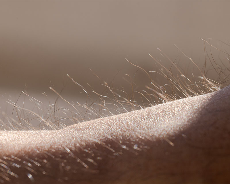 hair removal electrology