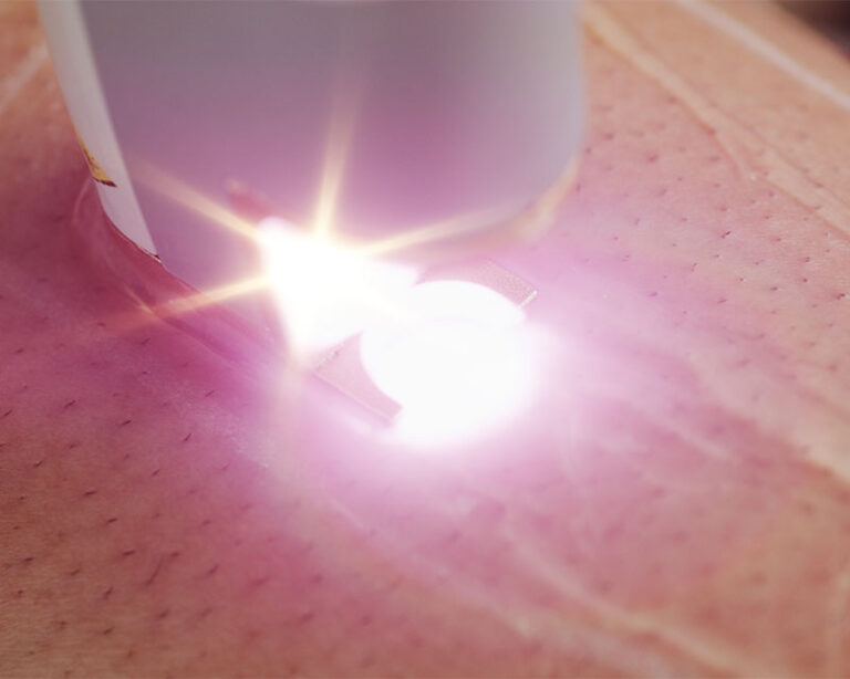 Electrolysis & Hair Removal Curriculum Milady